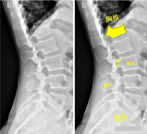 怎样发现骨折的可能性,一招看出手指骨折