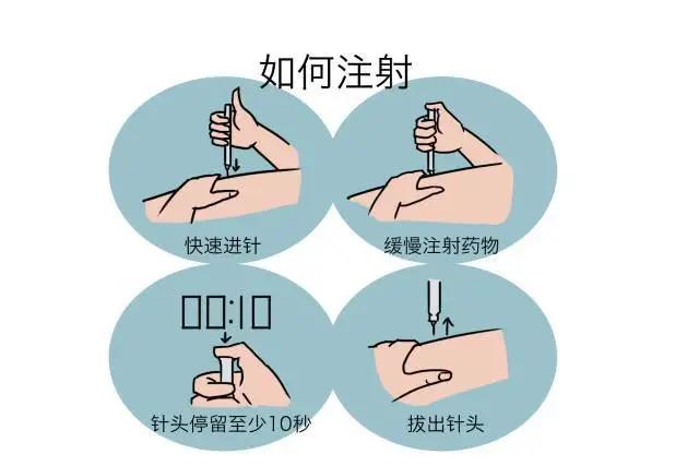 糖尿病引起的皮肤瘙痒药,治糖尿病的胰岛素泵使用方法