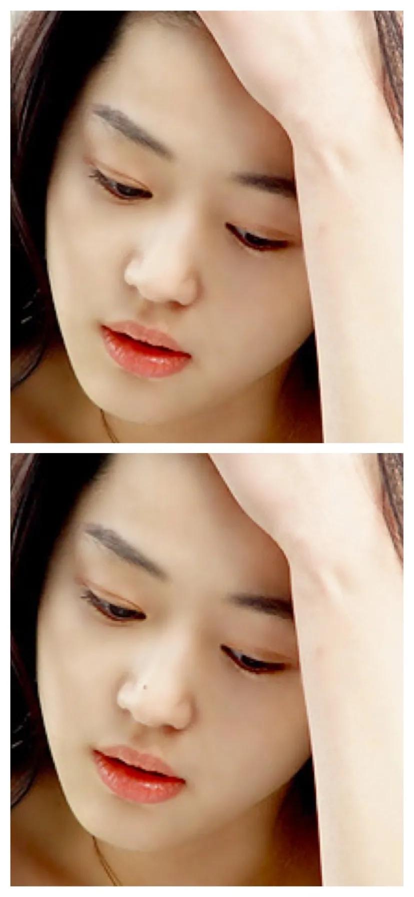 全脸点痣变美,点痣能变美吗