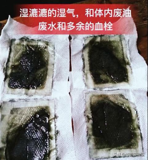 足贴祛湿气排毒怎么是黑的,足贴祛湿气排毒是真的吗