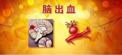脑出血病因科普视频,脑出血病因有哪些