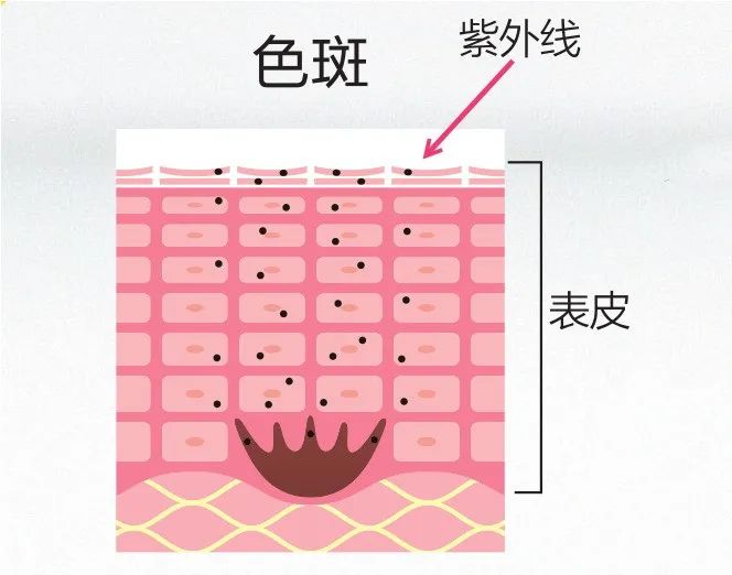 秦海璐紧致皮肤,秦海璐美白皮肤