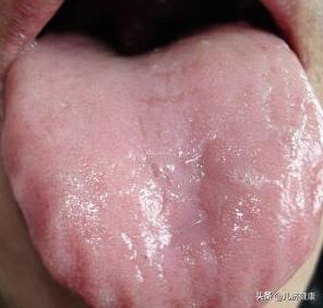 养脾祛湿最有效的方法,健脾胃祛湿好方法