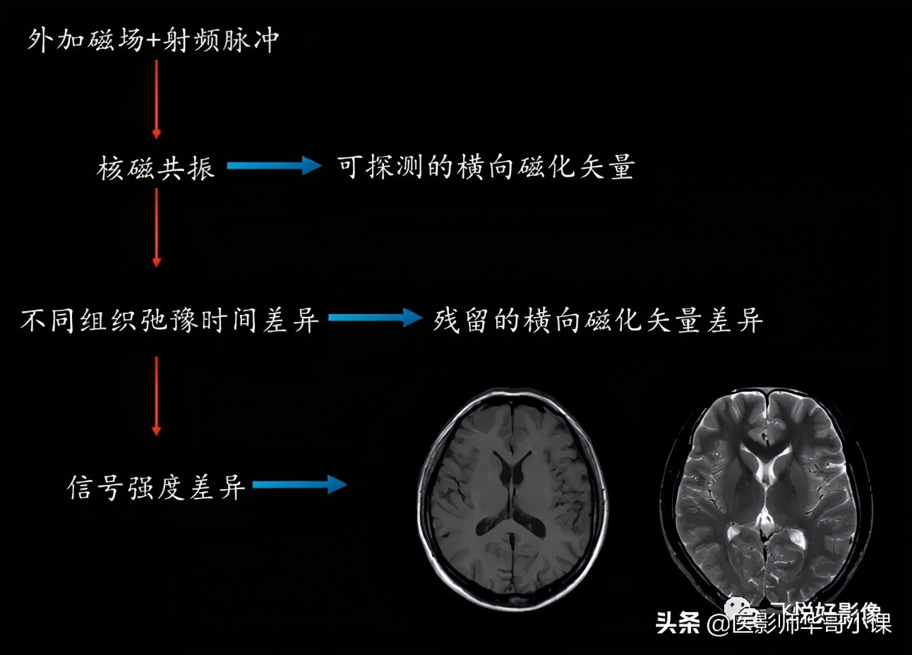 飞利浦磁共振图像操作,飞利浦磁共振成像序列及应用