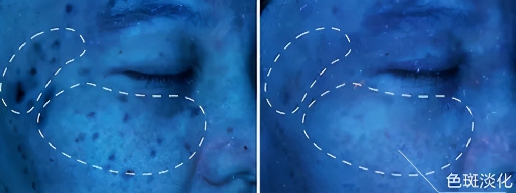 老字号祛斑面霜,一瓶祛斑的面霜