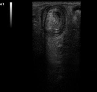 雨女无瓜的佛系带娃：孩子频繁呕吐要警惕！出现这一情况或要手术