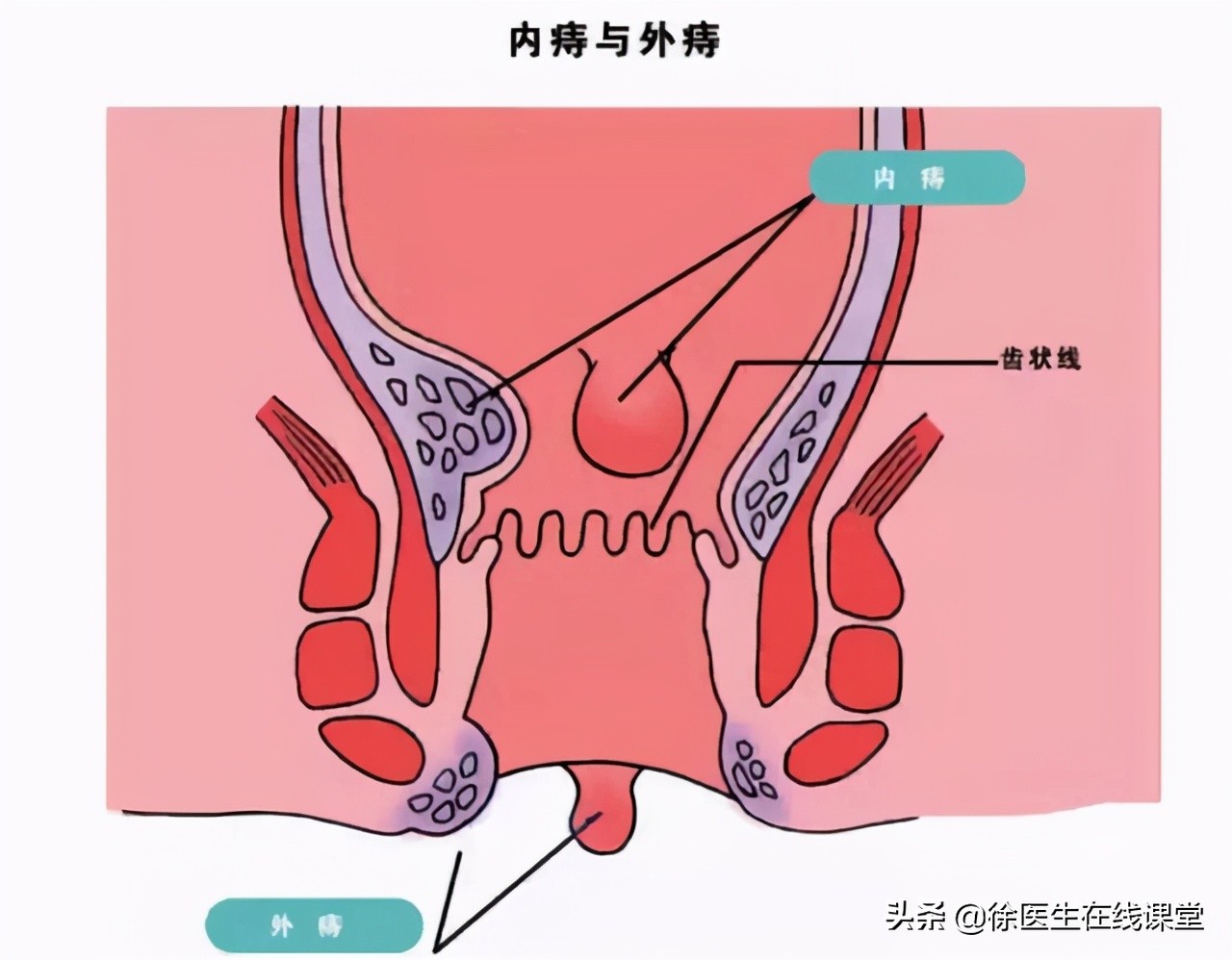 甲硝唑便宜又实用都能搞定哪些病,甲硝唑哪一种见效快图片