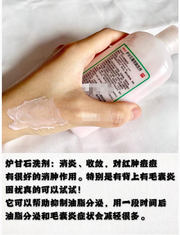 祛痘医学用品,便宜的祛痘用品