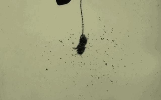 孩子膀胱容量130,儿童最大膀胱容量197正常吗