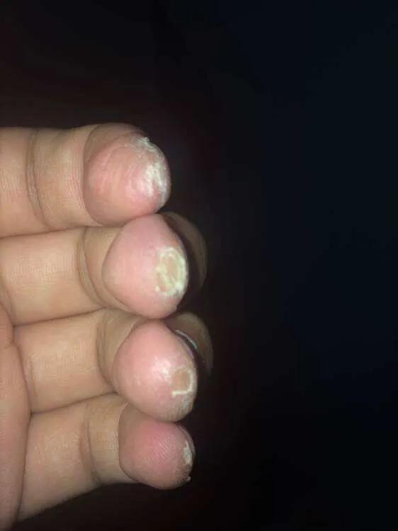 学习吉他会有哪些困难。