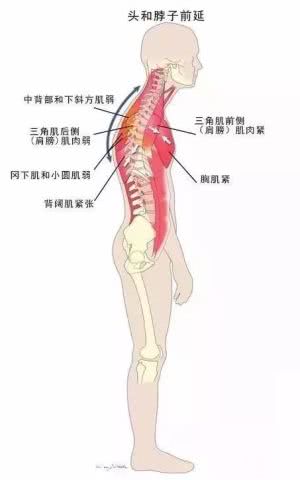 拉伸脖子会让斜方肌越来越大吗,脖子两侧肌肉变粗的方法