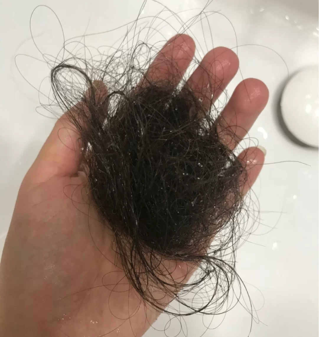 超市洗发水黑榜,阿道夫脱发不控油,飘柔一用就长头皮屑,用过吗