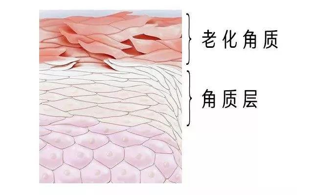 角质层薄脸上有红血丝怎么调理,角质层薄有红血丝脸发红怎么修复