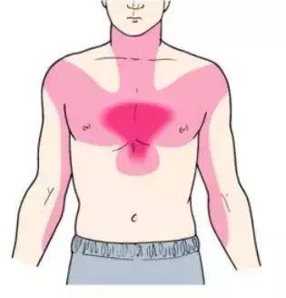 高危胸痛和低危胸痛鉴别,急性胸痛诊断和高危胸痛识别