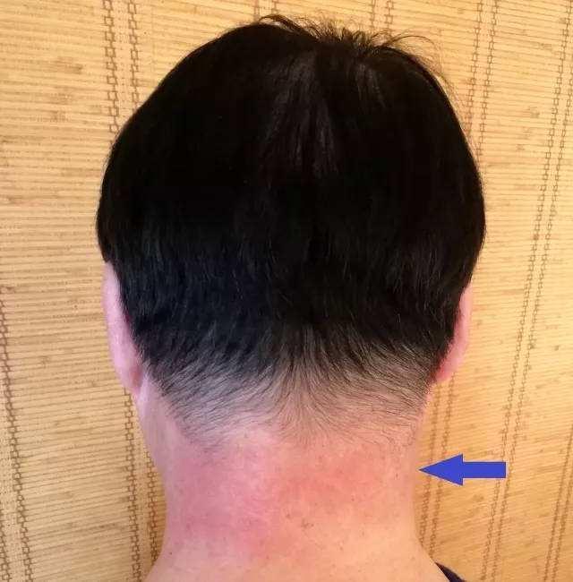 身体不舒服游泳容易发生什么危险,生病游泳最容易导致哪些生命危险