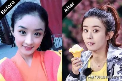 发际线最简单的补救方法,怎么有效的修复发际线