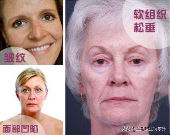 面部松弛严重只能做大拉皮手术吗,脸部皮肤松弛能做拉皮手术吗