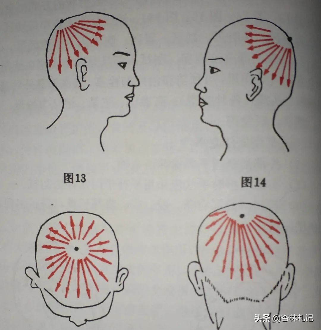 怎样刮痧脸部才是正确的,面部如何刮痧才正确