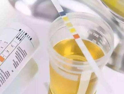 怀孕8周到12周之间还需要做检查么,怀孕12周之后多久产检一次