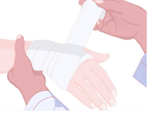 烧烫伤小科普,高温烫伤处理方法以及注意事项