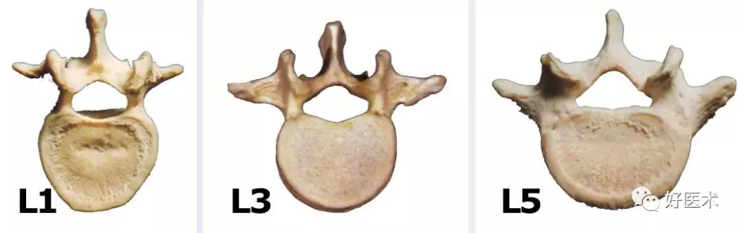 腰部ct需要注意事项,做腰部ct需要注意的事项