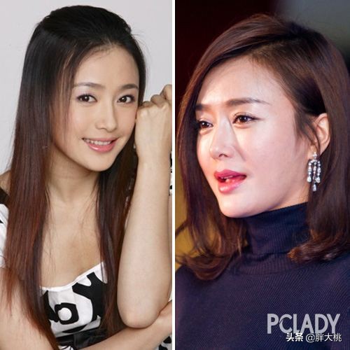 萧亚轩是不是打了玻尿酸一眼便知，明星没有玻尿酸会怎么样？