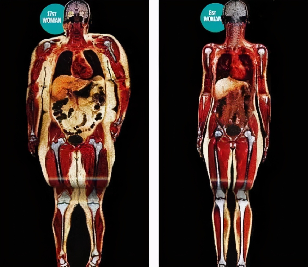 全身关节都有毛病怎么治,膝关节为什么会发炎