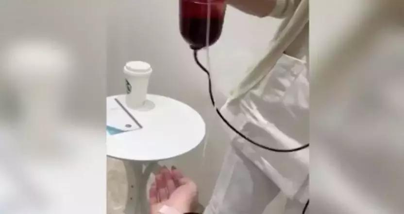 减肥出大事！用了网上爆红的方法，23岁姑娘紧急“换肝”捡回一条命