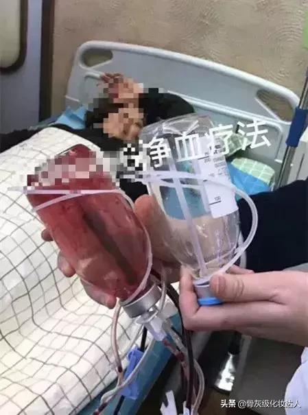 深扒小红书！灌肤、微针美白、换血，请问你不怕死吗？！