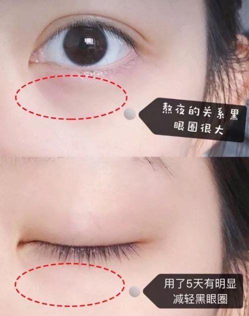 吴昕推荐眼霜好用吗视频,吴昕淡化细纹眼霜