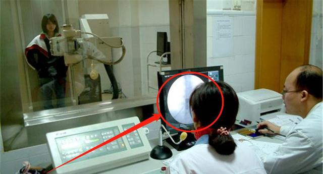 女生做胸透被医生要求,19岁女子做胸透后续