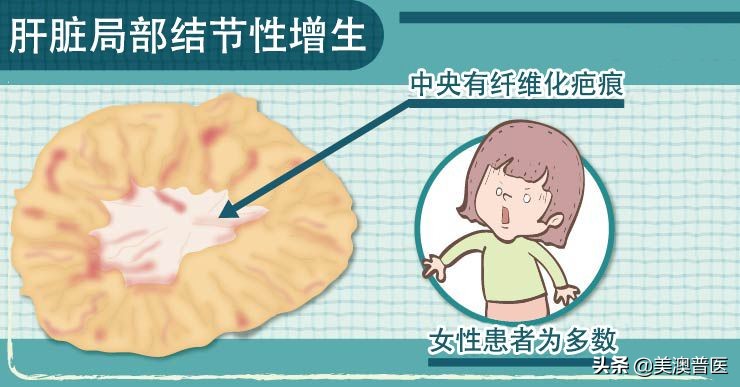 肝脏有阴影怎么进一步检查,肝脏发现肿瘤怎么办