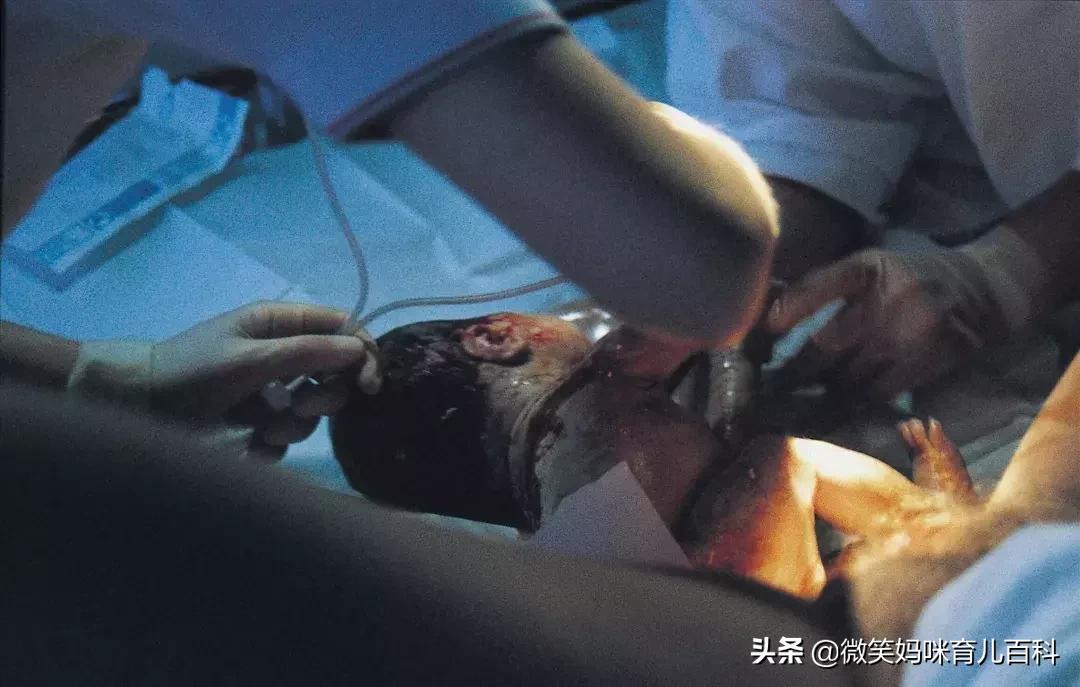 快生了有什么感觉是男孩,快生了的前兆有哪些