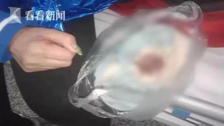 7岁男童被老师踢,7岁男孩被教练踢断大腿骨后续