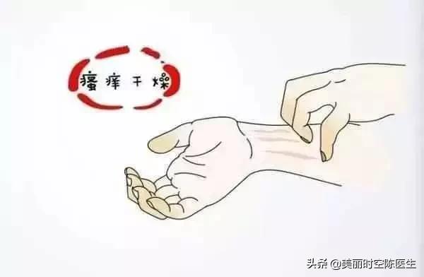 皮肤病中的“孙悟空”