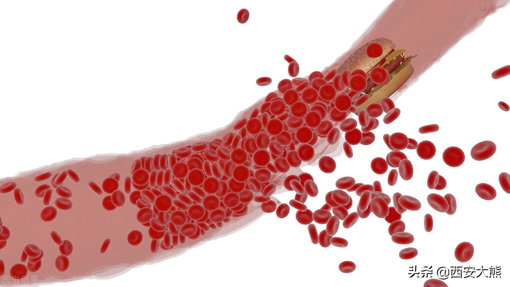 血管栓塞术后不停打嗝多久能好,血管栓塞术能评残吗