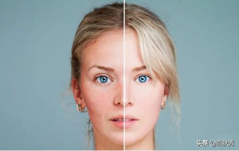 别再被所谓外油内干肤质忽悠了,适合外油内干肤质的温和护肤品