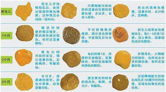 怎么学会判断宝宝的便便,怎么判断宝宝便便是否正常