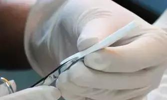 协和整形美容科专家,北京协和整形鼻综合