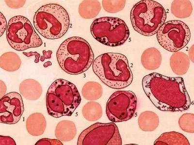 血液科病人预防出血措施,再障这种恶性血液病该怎么预防