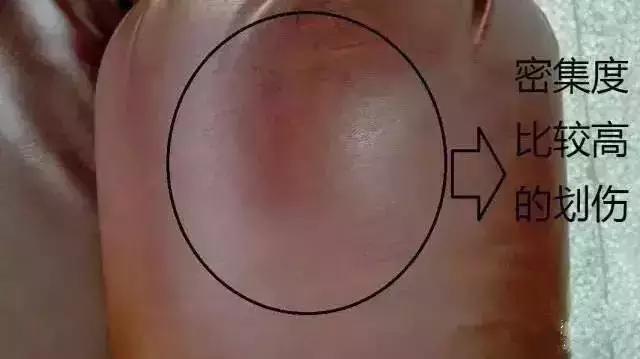 真皮沙发牛皮能修复吗,牛皮上的疤痕怎么去除