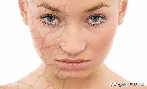 春暖花开过敏症状,春暖花开时预防过敏方法