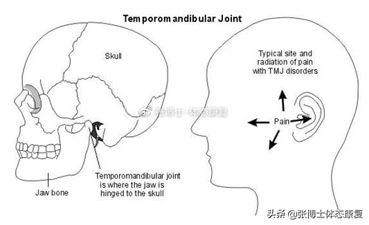 「译文分享」头颈姿势与颞下颌关节疼痛的关系