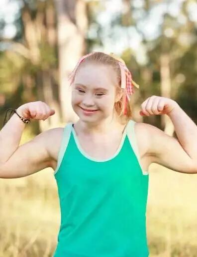 唐氏综合征中国美女,患有唐氏综合征的维密模特