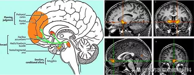 精神病人的前世,精神科药物的前世今生