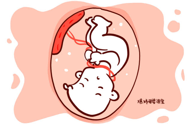 38胎位不正脐带绕颈2周还能矫正吗,孕妈胎位不正的原因及纠正方法