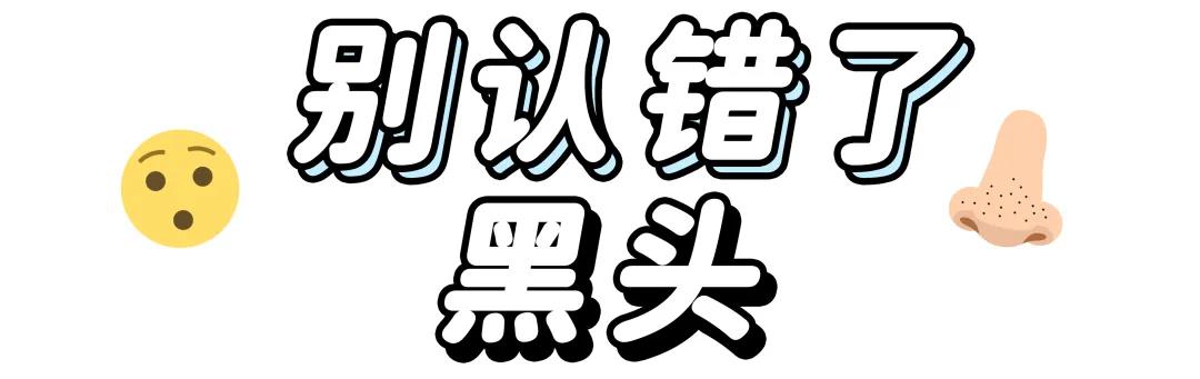 去除黑头最有效而且还简单的方法,教你如何一招去除黑头你学会了吗