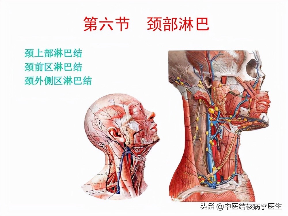 肺外结核——颈淋巴结结核