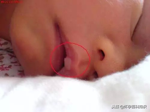 新生儿30个常见问题及处理技巧,新生儿一个月常见问题