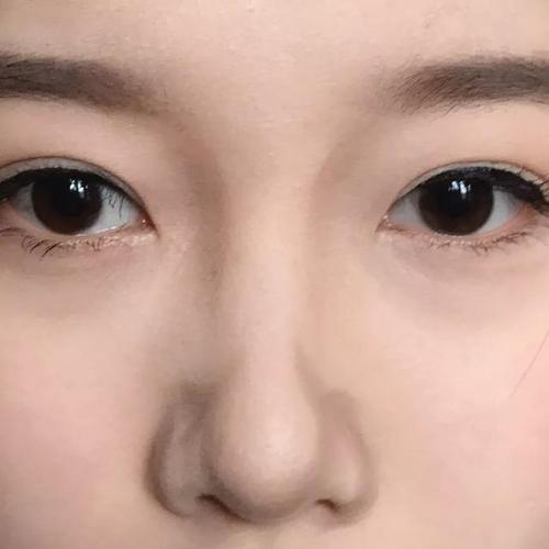 鼻子不好看的人怎么办,鼻子怎么看出来好不好看